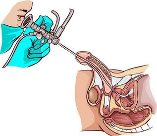 Procedura ureteroskopii